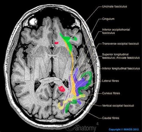 Brain - White matter : Association fibres of telencephalon, Superior ...