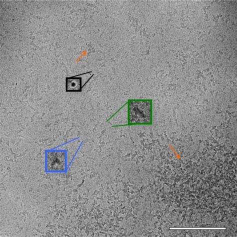 Cryo-TEM of liposomes. Cryo-TEM image of liposomes (8 mg/mL... | Download Scientific Diagram