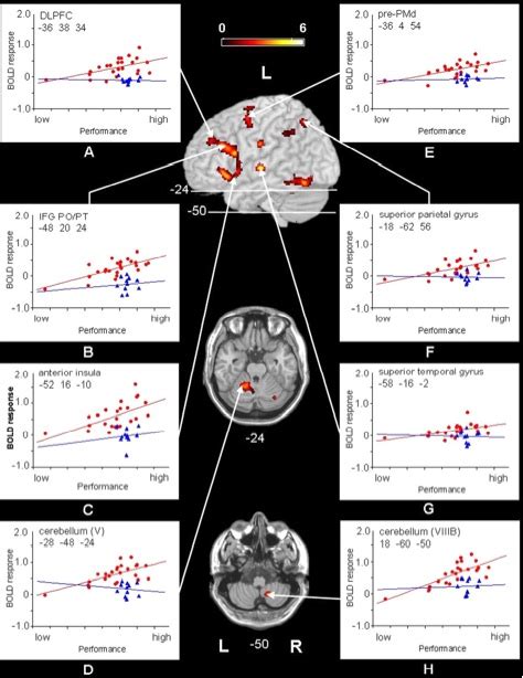 Deric's MindBlog: Compensatory neural plasticity in aging human brains.