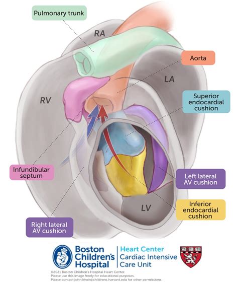 Embryology of conotruncal defects – Online supplement