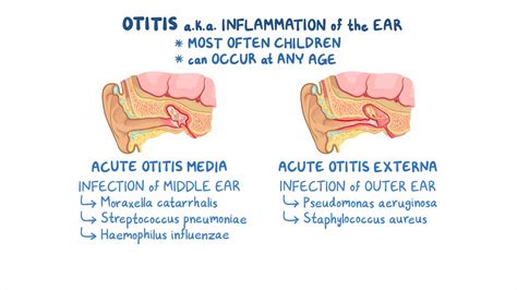 Otitis media and externa (pediatrics): Clinical sciences - Osmosis ...