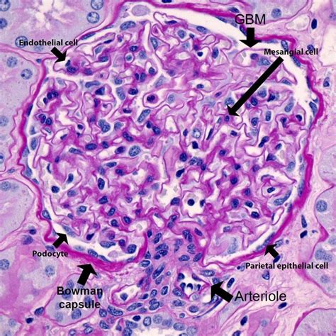 Kidney Biopsy of the Month: What is Normal? - Renal Fellow Network