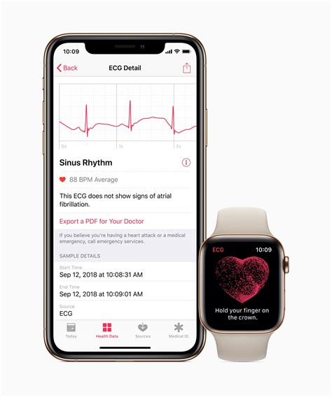 How to use the ECG app on Apple Watch