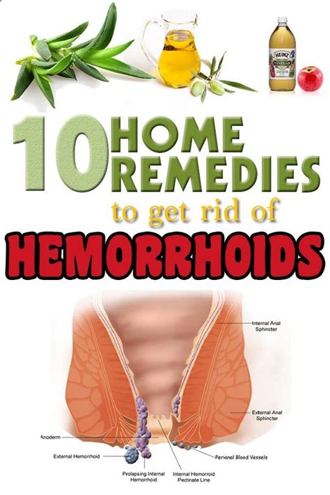 How to Naturally Get Rid of Hemorrhoids – 10 Home Remedies | Getting ...