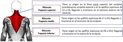 Músculo trapecio | Dolopedia