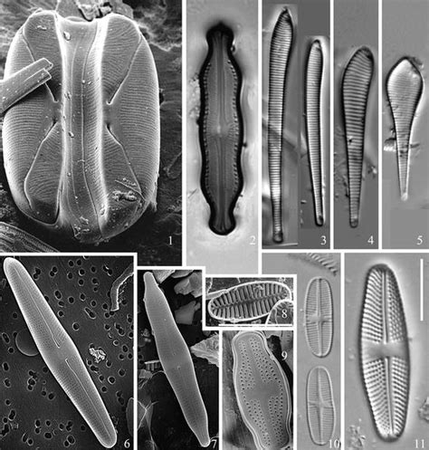 11 Selected freshwater diatoms endemic to (parts of) the Southern... | Download Scientific Diagram