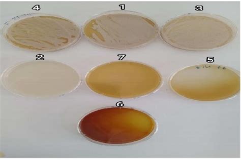 Growth of the yeast Brettanomyces bruxellensis on differential media... | Download Scientific ...