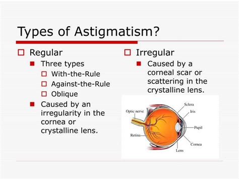 PPT - ASTIGMATISM PowerPoint Presentation - ID:1428237