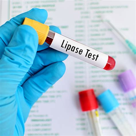 Tampa Lipase Test - 24/7 Labs