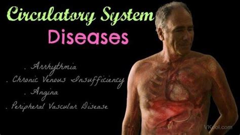 4 Common circulatory system diseases