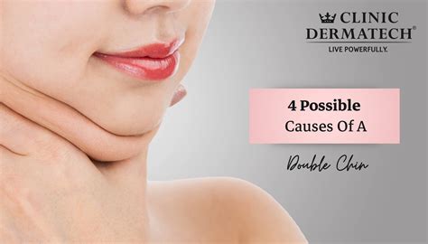 4 Possible Causes Of A Double Chin At Clinic Dermatech