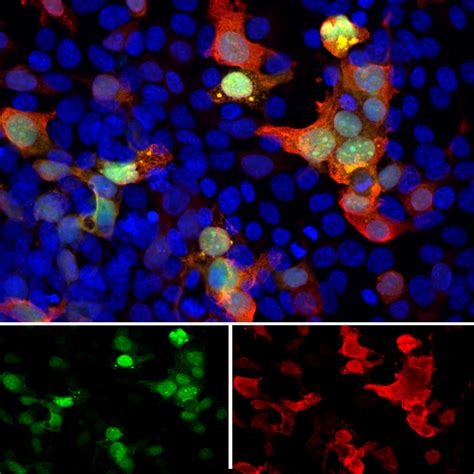 Goat Polyclonal Antibody to GFP Cat# GPCA-GFP – EnCor Biotechnology