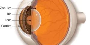 Zonules - American Academy of Ophthalmology