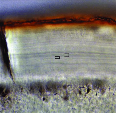 The tooth cementum band under the microscope. The identification and ...