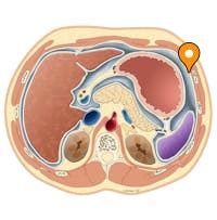 Extraperitoneal space - e-Anatomy - IMAIOS