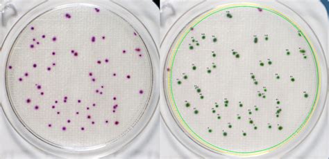 What Are Colony Forming Units?