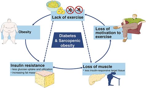 Frontiers | Diabetes and Sarcopenic Obesity: Pathogenesis, Diagnosis, and Treatments