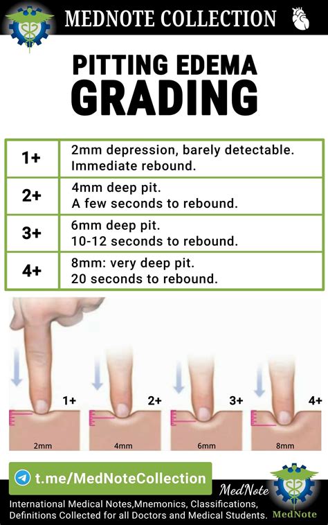 Pitting Edema Levels