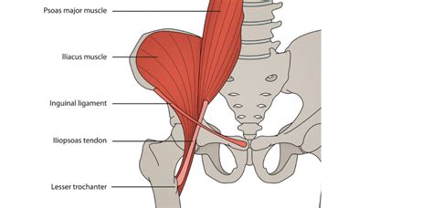 Iliopsoas Tendonitis Symptoms Causes Treatment Preventions & More All you need to know - Symptom ...