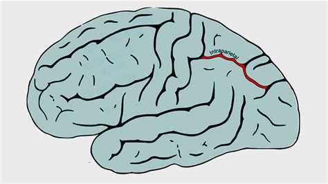 Neurofeedback in dyscalculia learning disability | Effective NFB protocols