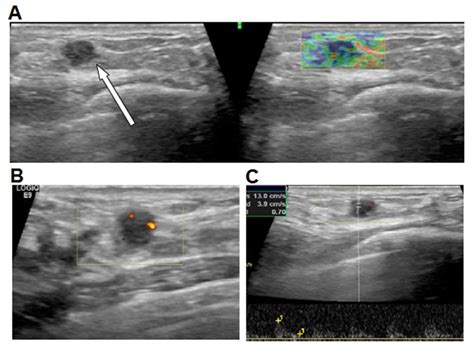 Diagnostic evaluations of ultrasound and magnetic resonance imaging in ...