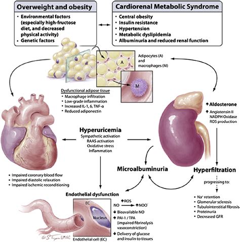 Diabetic Kidney Disease and the Cardiorenal Syndrome - Endocrinology ...