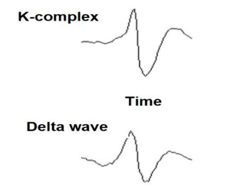 Brain waves: K-complex and sleep spindle [49]. | Download Scientific Diagram