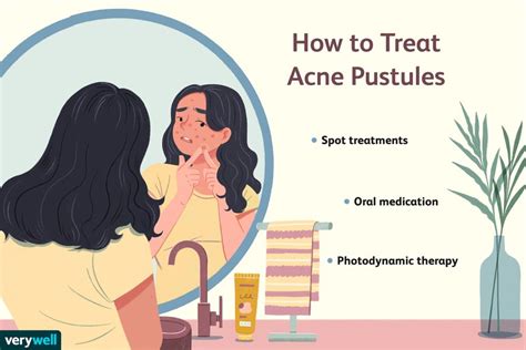 Acne Pustules: Symptoms, Causes, Diagnosis, Treatment, and Prevention