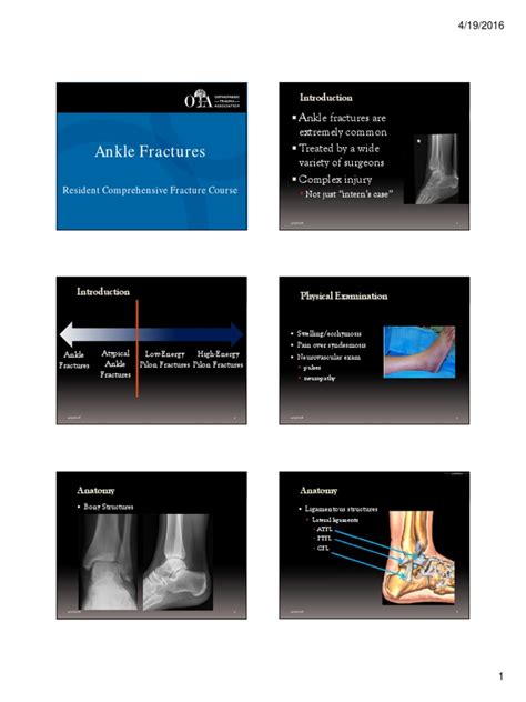 1 Ankle Fractures Handout | PDF | Ankle | Medicine