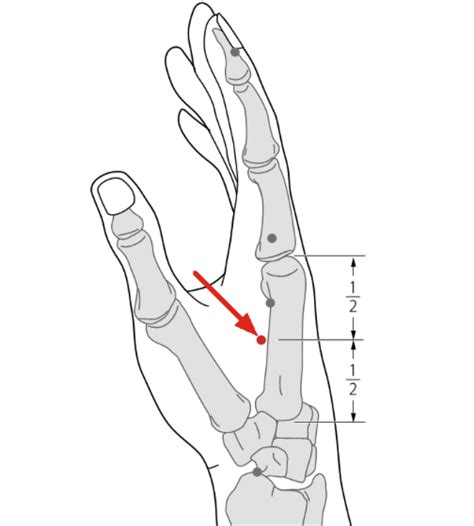 Large Intestine 4 | Accupuncture, Acupressure, Acupressure points