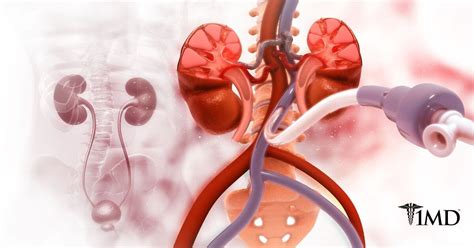 Peripheral Vascular Disease: Symptoms, Causes, and Diagnosis | 1MD ...