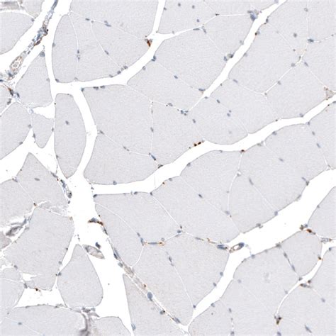 Cathepsin B Antibody (PA5-82618)