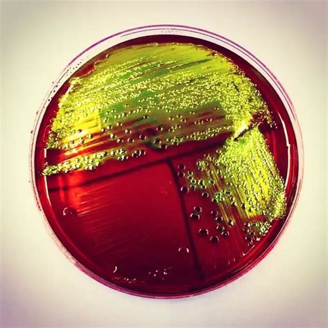 EMB Agar: Composition, Principle, and Colony Morphology • Microbe Online
