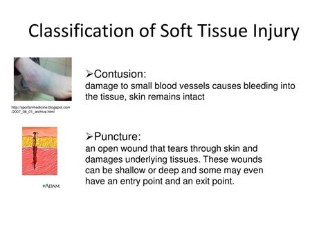 PPT - Soft Tissue Injury PowerPoint Presentation, free download - ID:1634436