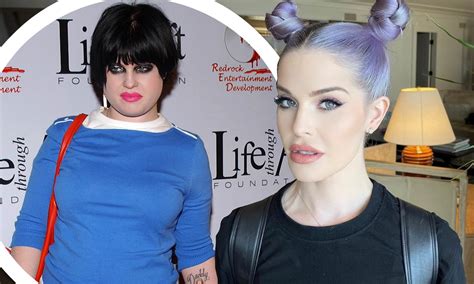 Kelly Osbourne Before And After Plastic Surgery