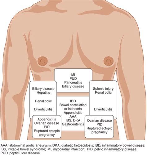 Nyeri Abdomen: Diagnosis Berdasarkan Gejala - WhiteCoatHunter