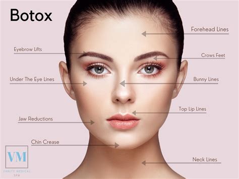 Botox Treatment in Teaneck, NJ. Call Vanity Medical Spa Now