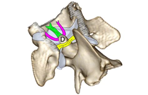 Canine Atlantoaxial Instability - NDSR