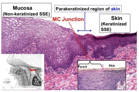 Mucogingival Junction Histology | The Best Porn Website