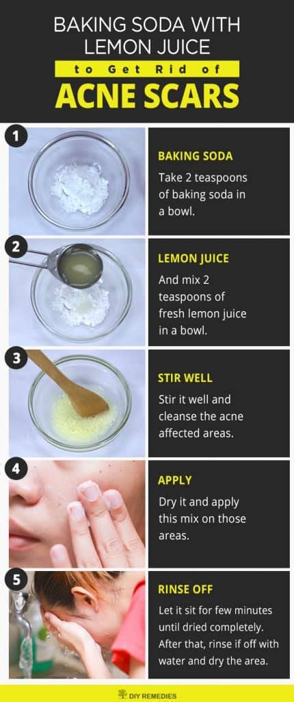 How to Get Rid of Acne Scars using Baking Soda