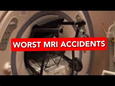 Worst MRI Accidents | MRI Magnet Strength | MRI and Metal #mrincredible ...