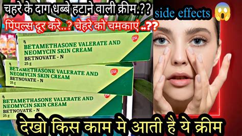 यह वीडियो बेटनोवेट-एन क्रीम के बारे में आपका नजरिया बदल देगा | Betnovate-N cream uses |side ...