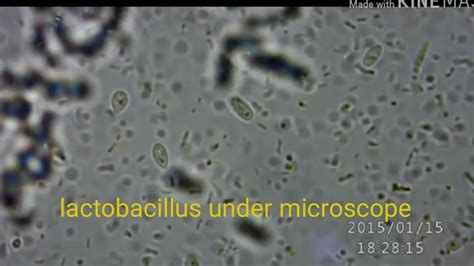 Lactobacillus under microscope - YouTube