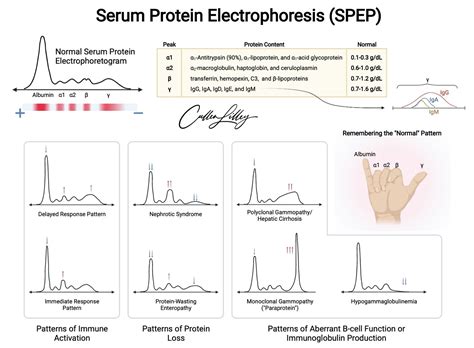 Electrophoresis Multiple Myeloma