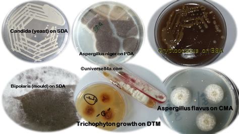 Fungal Culture Media: Introduction, Principle, Preparation, Test Procedure