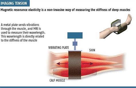 Painless way to gauge deep muscle stiffness | New Scientist