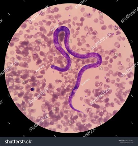 Heartworm Microfilaria