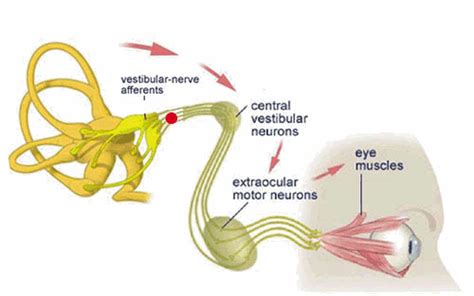 Getting past double vision one day at a time: The vestibular system and ...