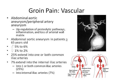 Groin Pain Steven Tippett 2042