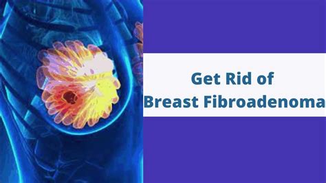 Breast Fibroadenoma Treatment Without Surgery in Hyderabad | VABB ...